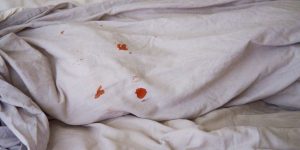 نحوه از بین بردن لکه خون از ملاحفه و ملافه